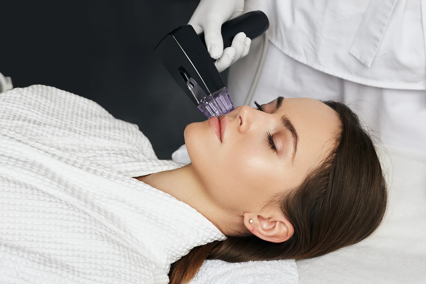 Does-RF-Microneedling-Work