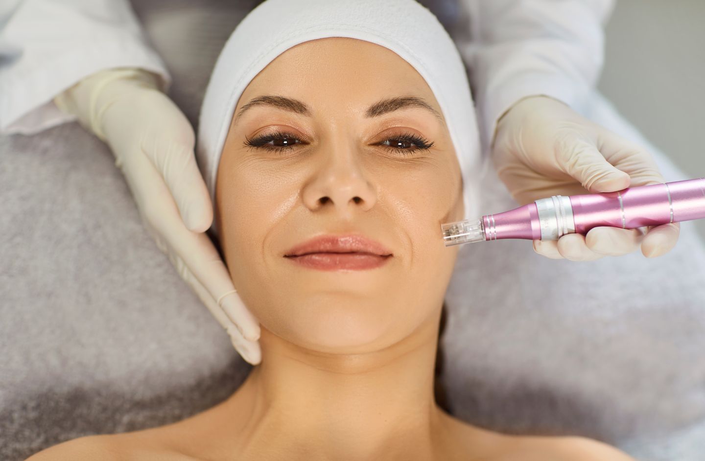 woman receiving microneedling pen facial treatment from licensed esthetician